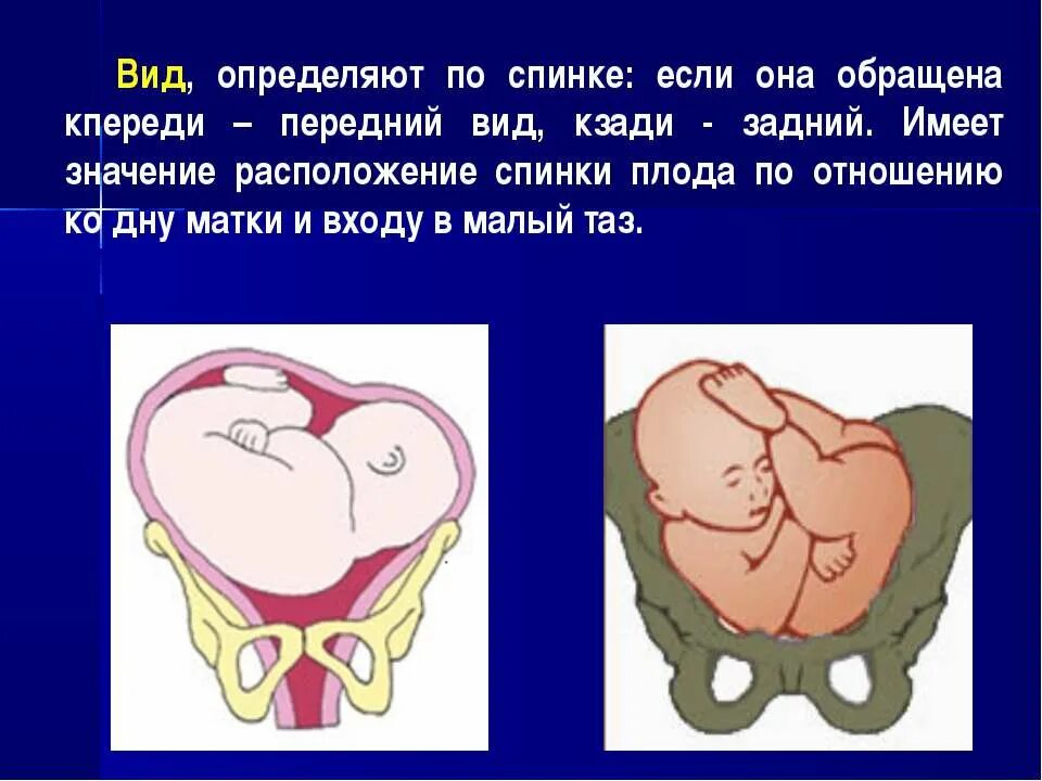 Какое должно быть предлежание. Продольное головное предлежание плода. положение плода поперечное головное. поперечно предлежание плода. положение плода продольное переднее.