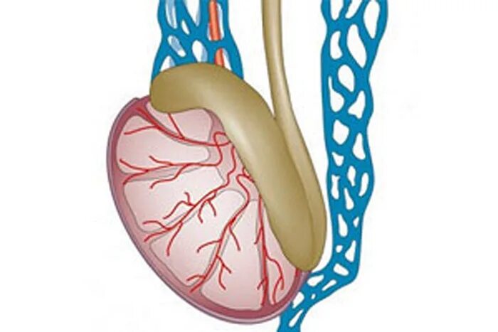 Варикоз вен семенного канатика. Варикозное расширение вен семенного канатика яичка.. Варикоцеле – расширение вен семенного канатика. Варикоз сосудов семенного канатика. Артерии яичка