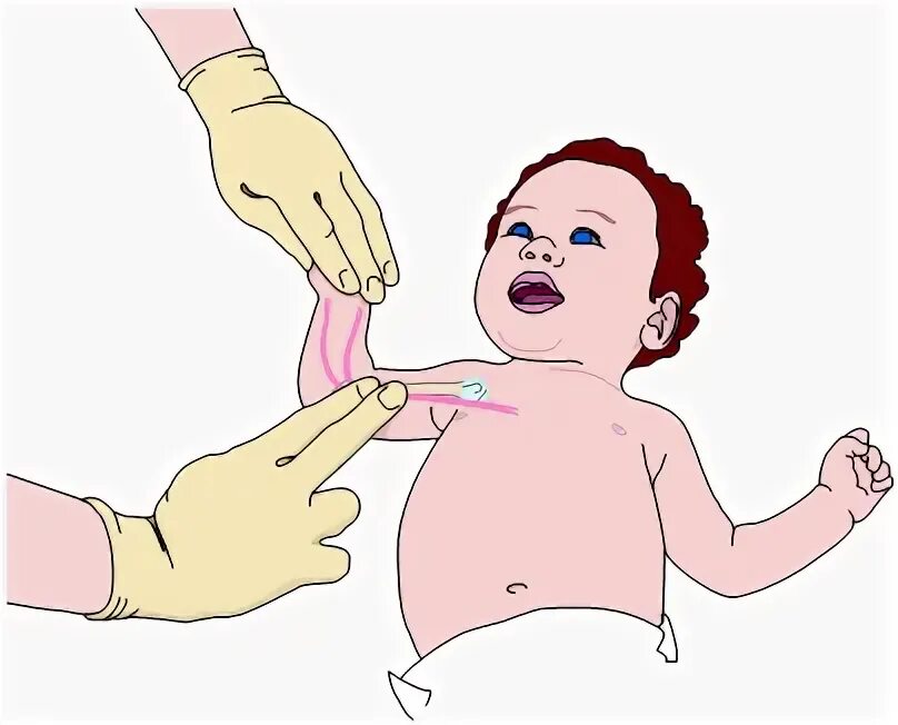 Подсчет пульса у детей. Исследование пульса у детей. Измерение пульса у новорожденного. Измерение пульса у грудного ребенка. Исследование пульса у новорожденных.