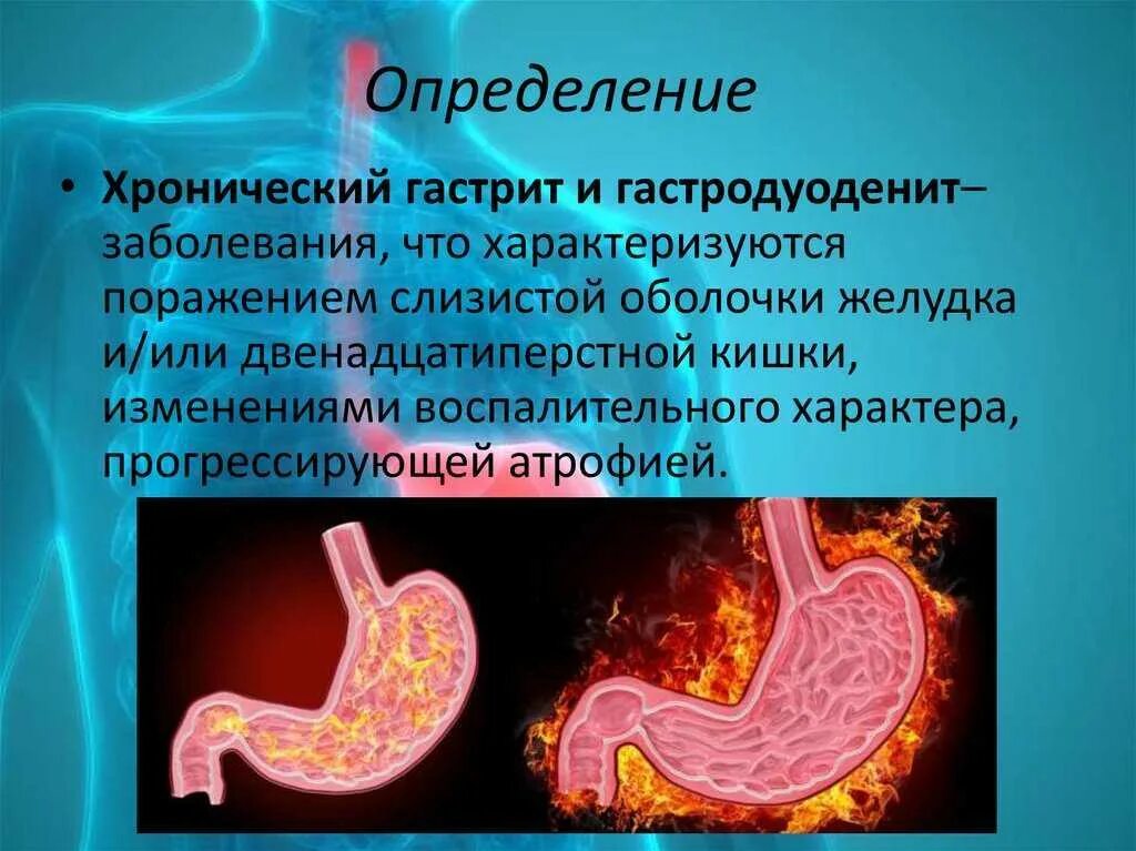 Гастродуоденит причины. Хронический гастродуоденит. Хронический гастрит и гастродуоденит. Хронический поверхностный гастродуоденит. Гастрит и гастродуоденит.