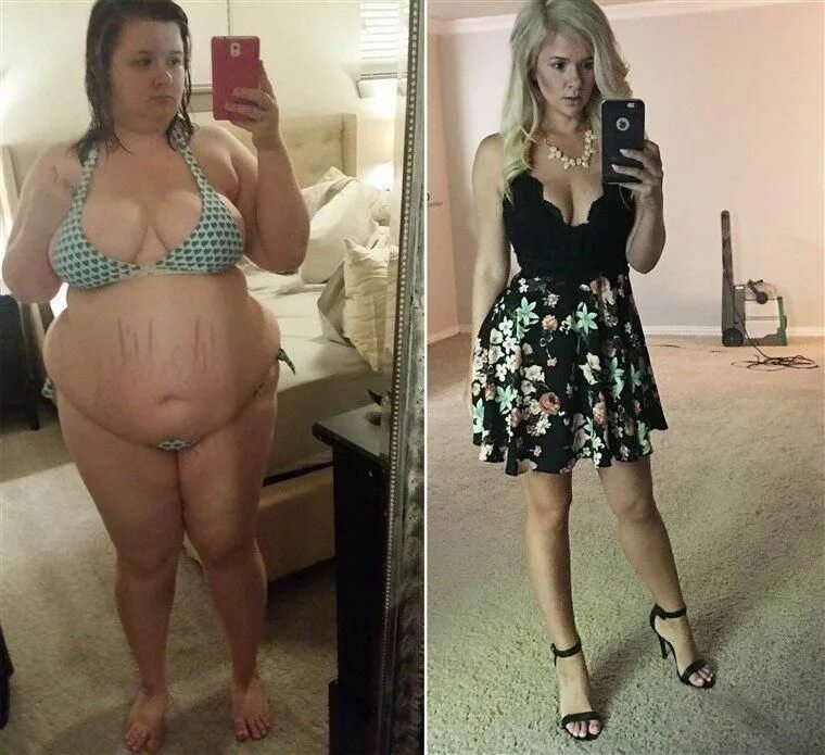 Была толстой потом похудела. До и после похудения девушки. До и после похудения девушки мотивация. Стройные девушки до и после.