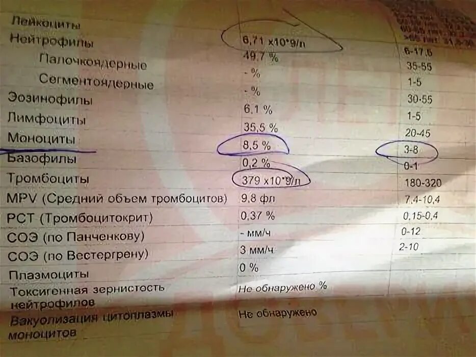 Моноциты повышен что это значит у ребенка. Моноциты повышены у взрослого. моноциты повышены у взрослого в крови у мужчины. завышены моноциты в крови у взрослого. моноциты повышены у ребенка в крови.