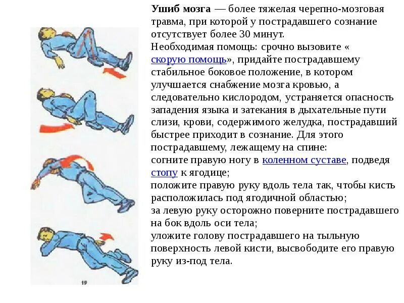 Упала затылком что делать. Положение тела пострадавшего. Положение тела при различных травмах. Положение пострадавшего после травмы. Положение пациента при ЧМТ.