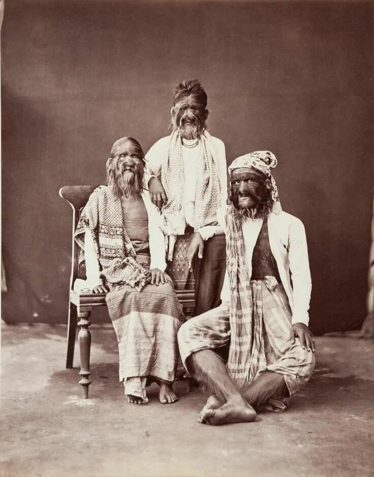 Hairy family. 1875 Бирма. Индийская волосатая семья.