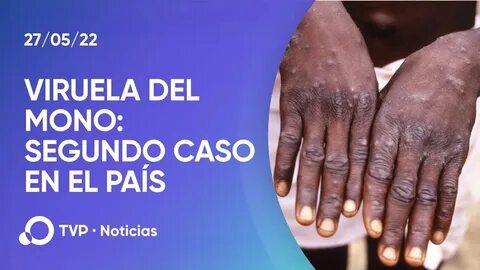 Mono de