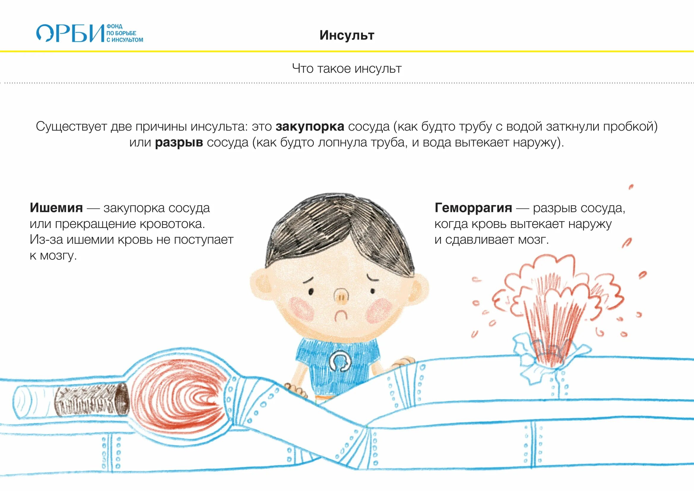 Инсульты у детей. Детский инсульт причины. Про инсульт детям плакат.