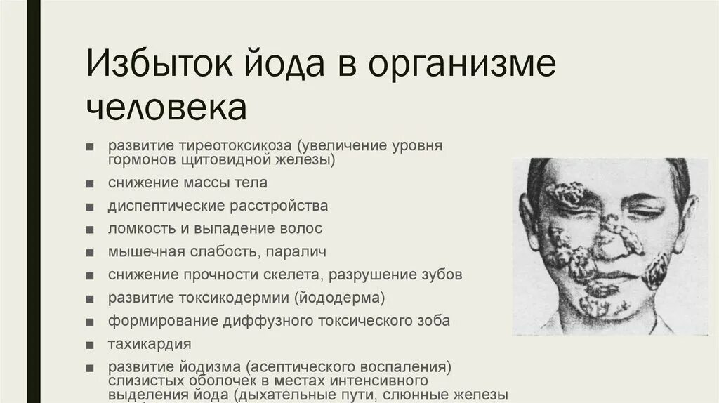 Недостаток гормона щитовидной железы вызывает. При избытке йода в организме симптомы у женщин. Заболевания при избытке йода в организме. Переизбыток йода в организме щитовидка. Профицит йода в организме симптомы.