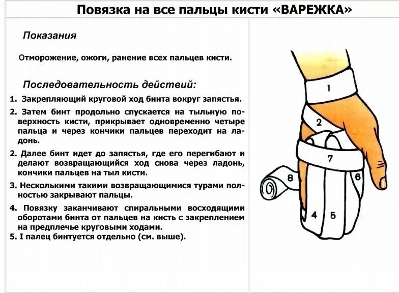 Техника наложения варежки. Наложение повязки варежка алгоритм. Техника наложения повязки варежка. Продемонстрировать технику наложения повязки на кисть «варежка».. Этапы наложения возвращающейся повязки на кисть.