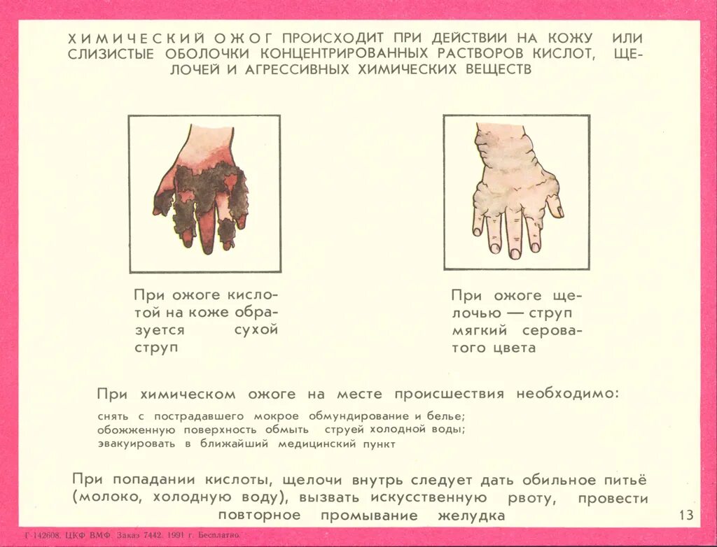 Вызвать рвоту с помощью пальцев. Как можно вызвать рвоту без пальцев в домашних условиях. Как вызвать рвоту с помощью 2 пальцев. Как легко вызвать рвоту