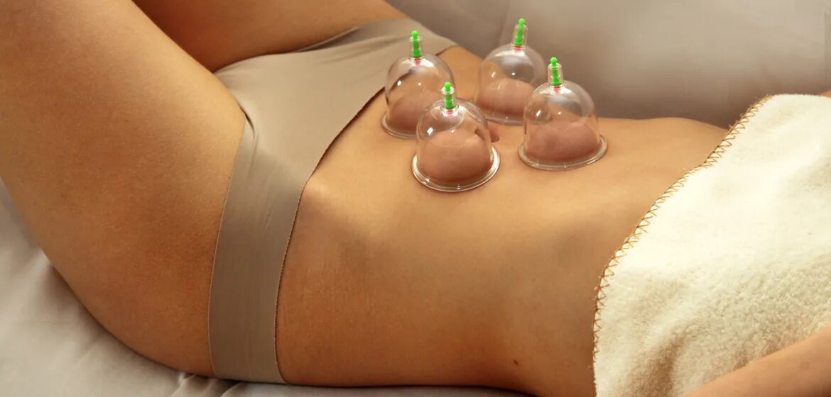 баночный массаж. вакуум терапия баночный массаж.