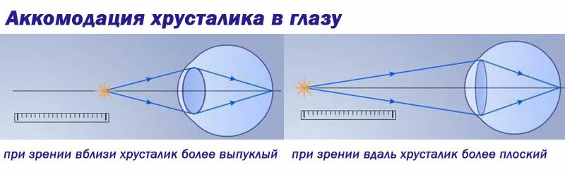 Аккомодация вблизи