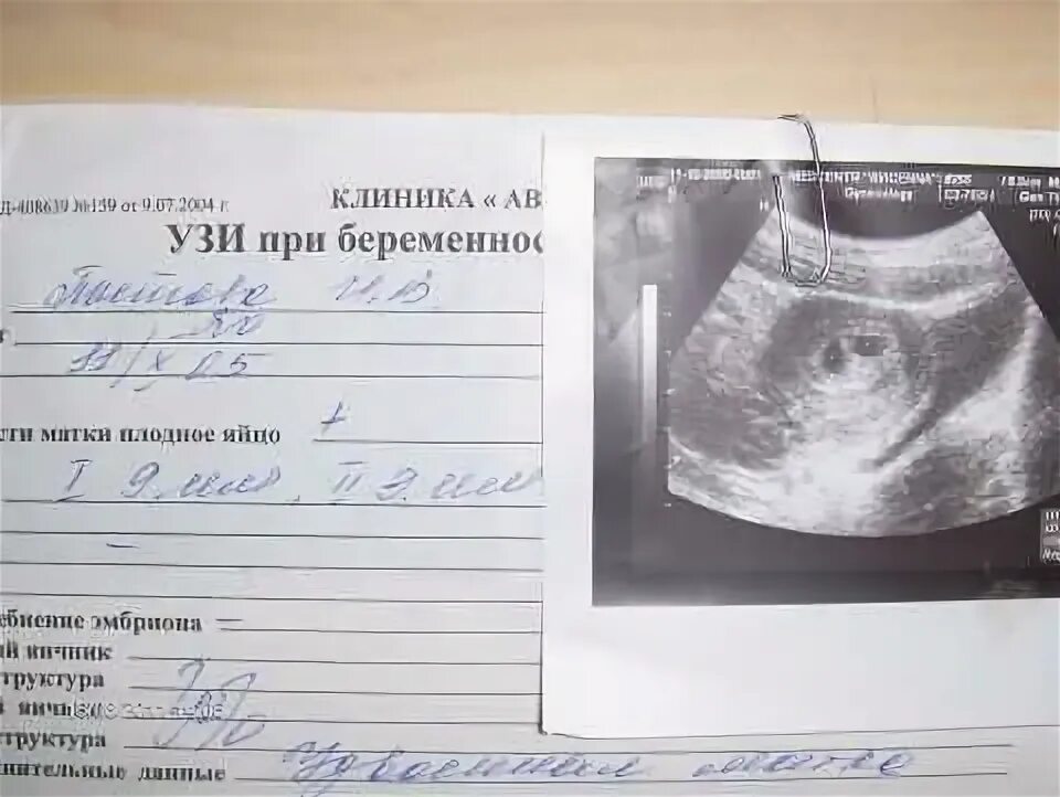 5 эмбрионов форум