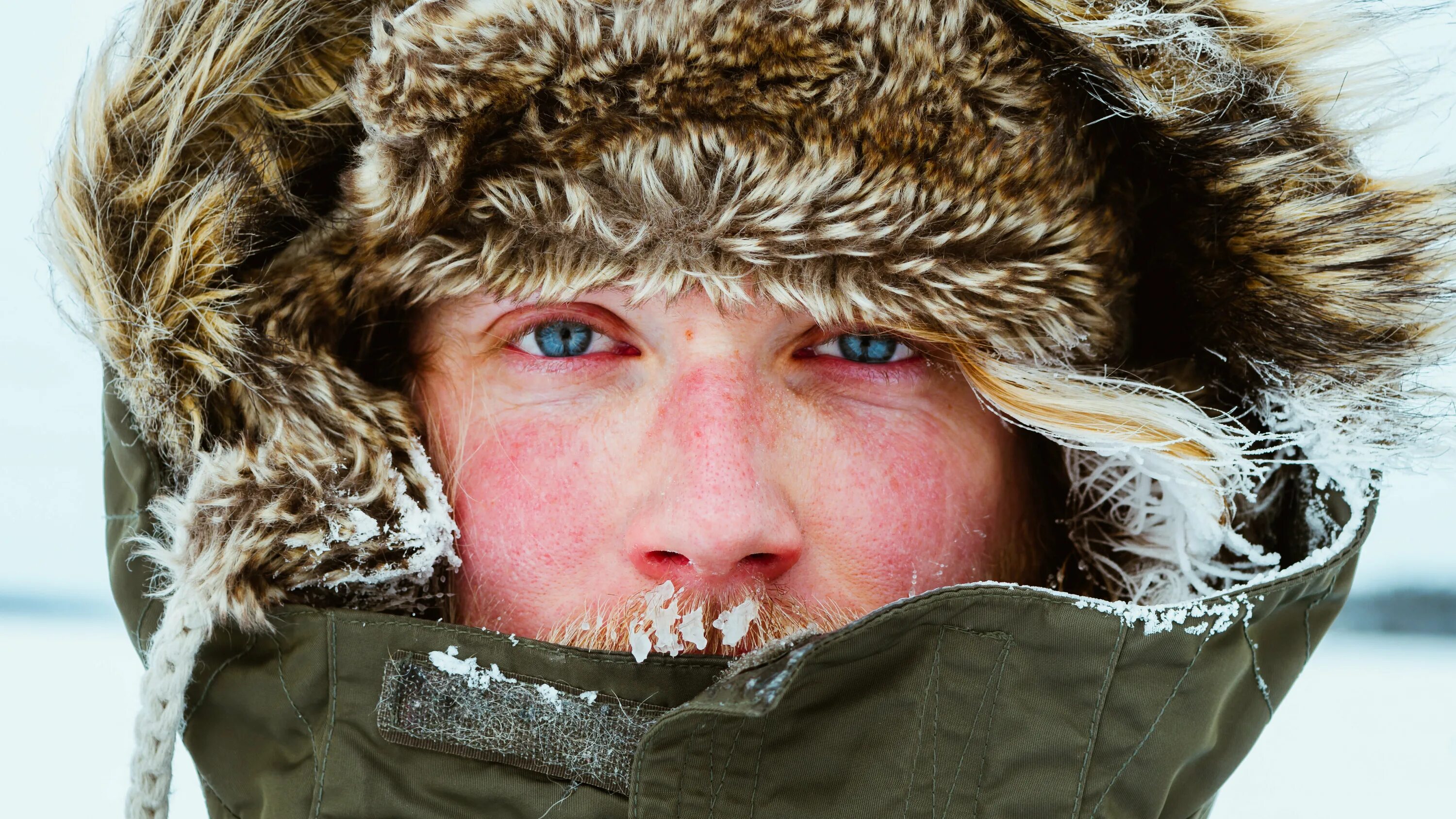 Холодовая аллергия на лице. Зимняя аллергия на холод. Cold лицо