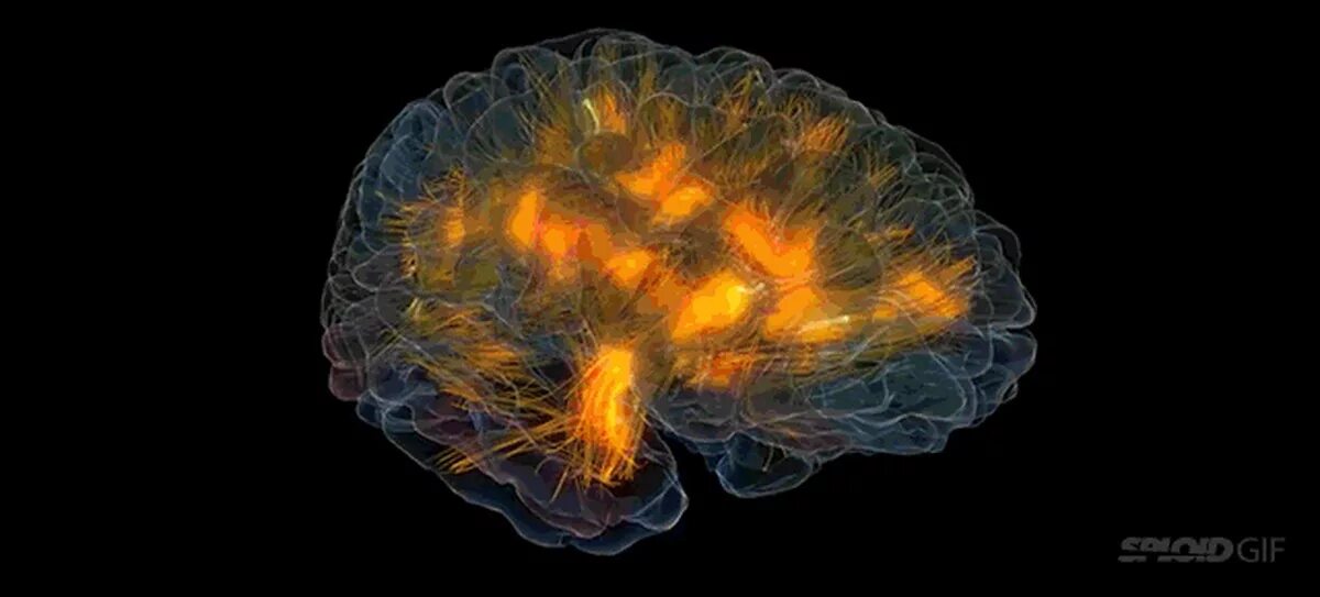 Нейронные связи в мозге. Мозг gif. Активность нейронов головного мозга.
