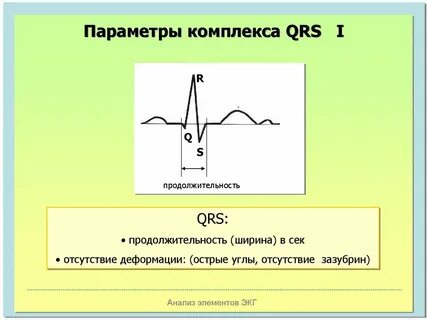 Комплекс qrs