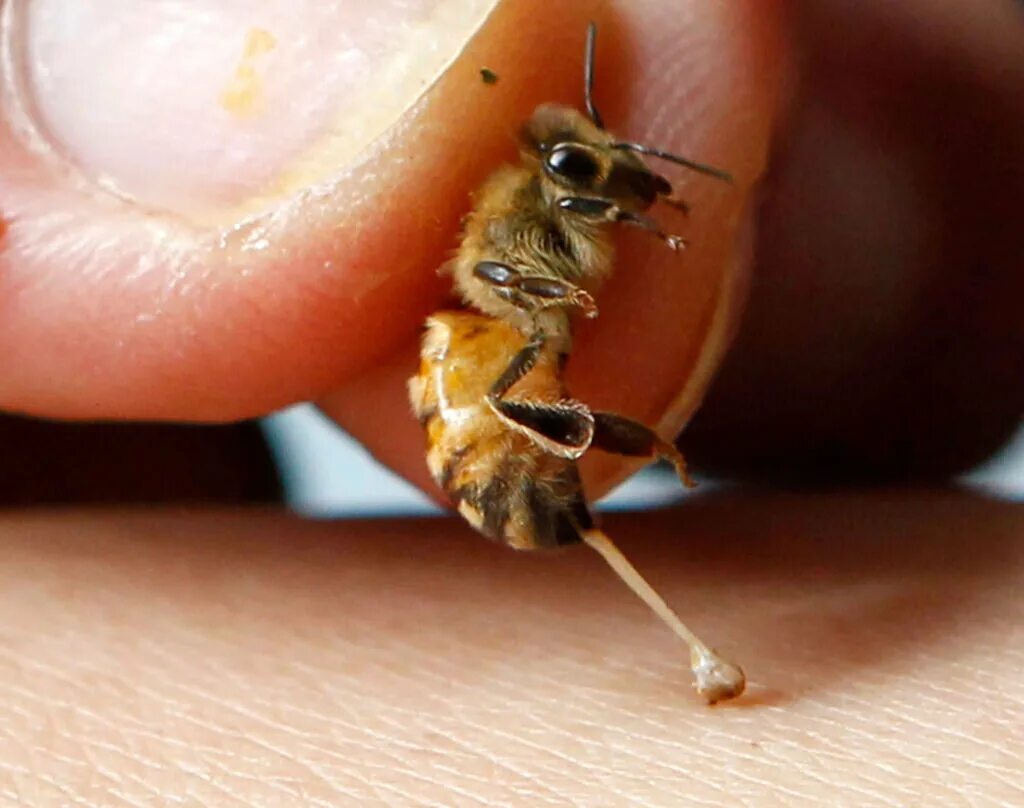 Шмель жалит или кусает. Пчелиный яд апитерапия. Апитоксин яд пчелы.