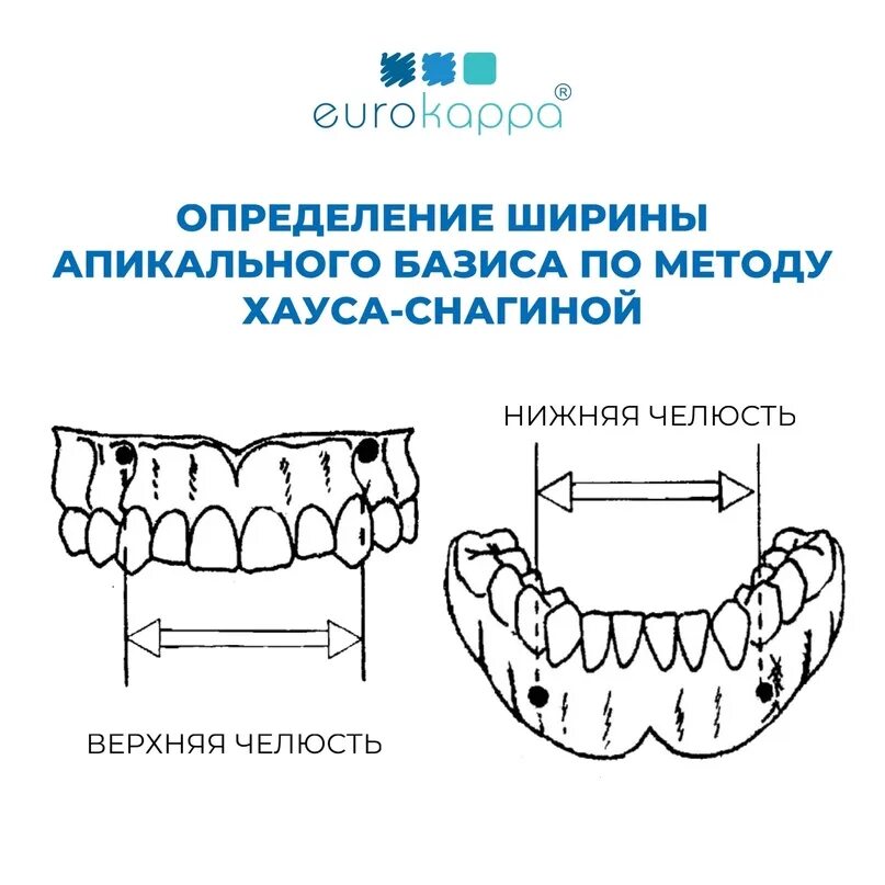 Калькулятор базиса. Апикальный Базис челюсти. Ширина апикального базиса. Методика Снагиной. Измерение апикального базиса.