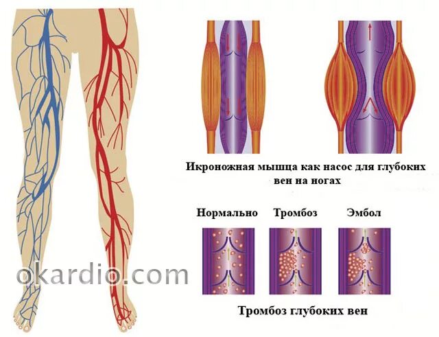Сильно болит вена. Тромбоз бедренной вены. Тромбоз икроножной вены. Тромбофлебит икроножной мышцы.