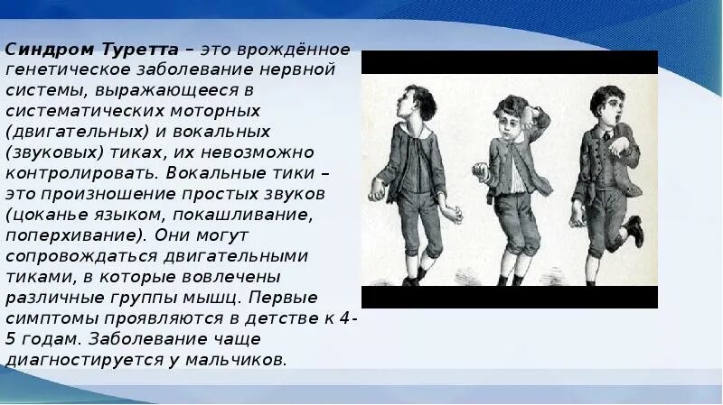 Синдром жиль де ля. Синдром Туретта. Синдром Торетто. Синдром Жиля де ля Туретта. Тики синдром.