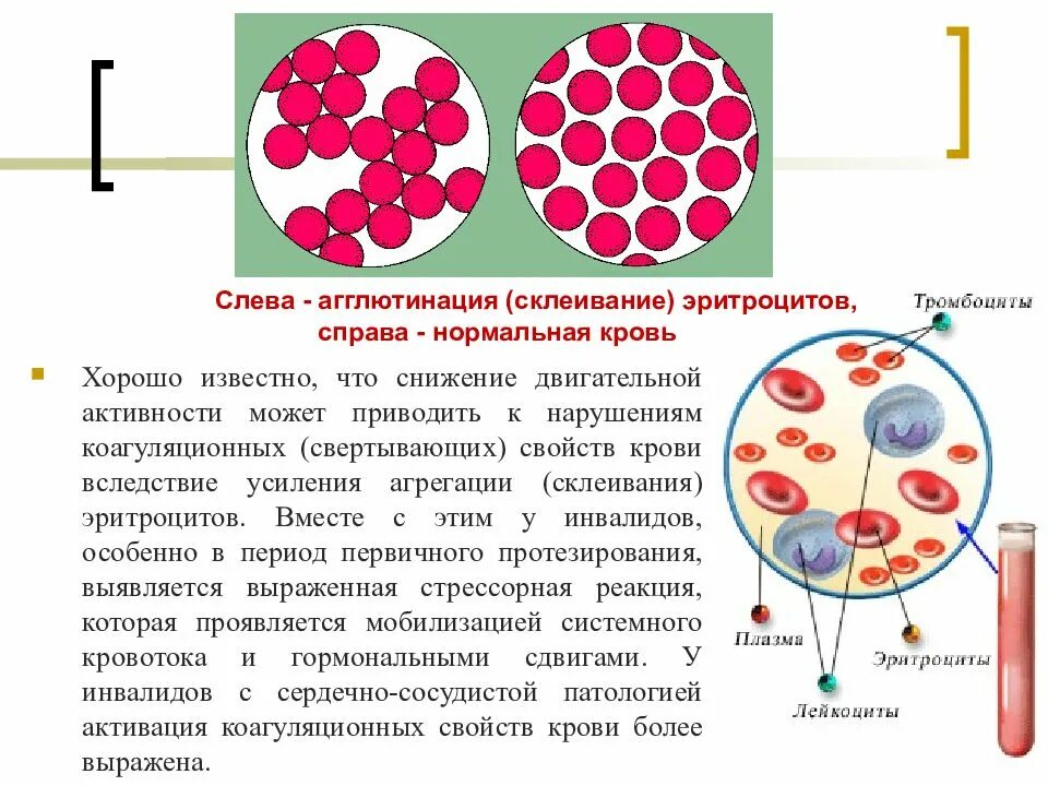 Склеивание крови. Агглютинация тромбоцитов. Агглютинация эритроцитов. Агглютинация это склеивание эритроцитов.