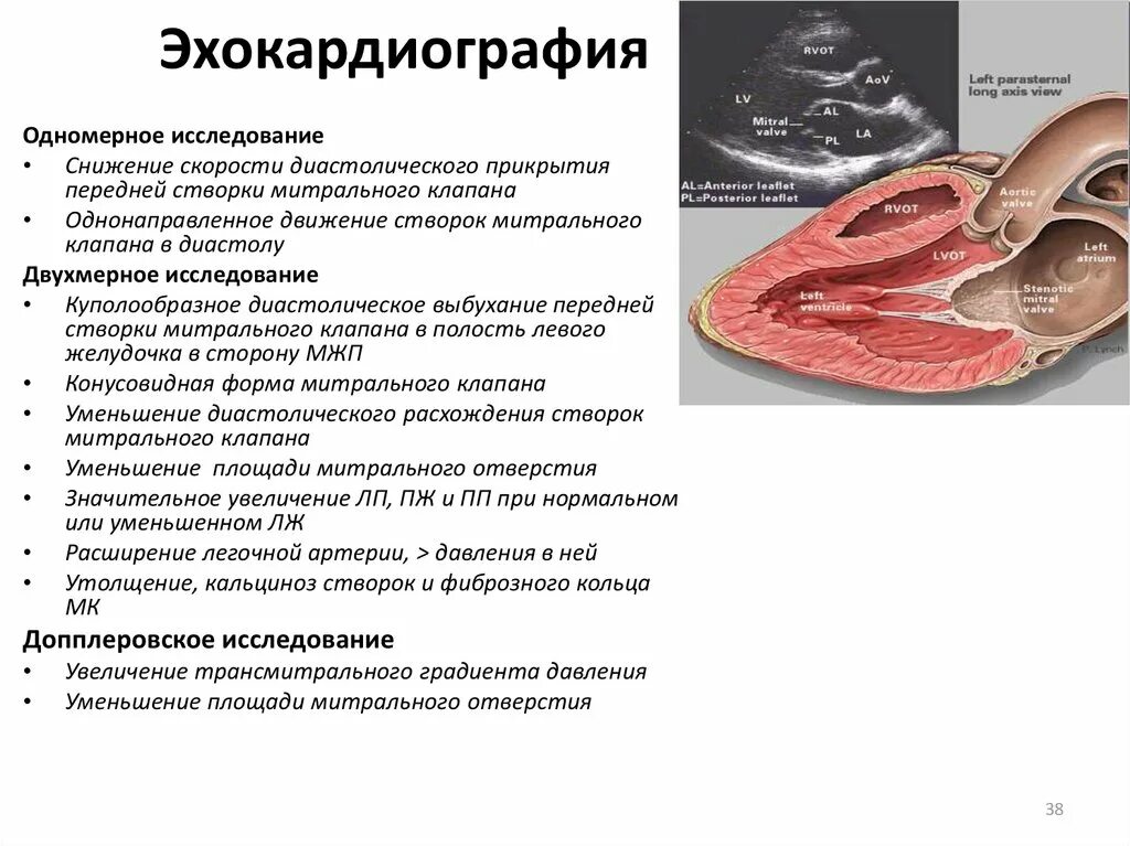 Стеноз аортального клапана эхокардиография. Кальциноз митрального клапана ЭХОКГ. ЭХОКГ эндокардит митрального клапана заключение. Стеноз митрального клапана на ЭХОКГ. Митральный стеноз признаки