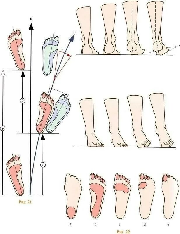 Движение стопы при ходьбе. Как выглядит плоскостопие сбоку. Правильная постановка стопы. Правильная форма женских ног. Как должны стоять ноги.