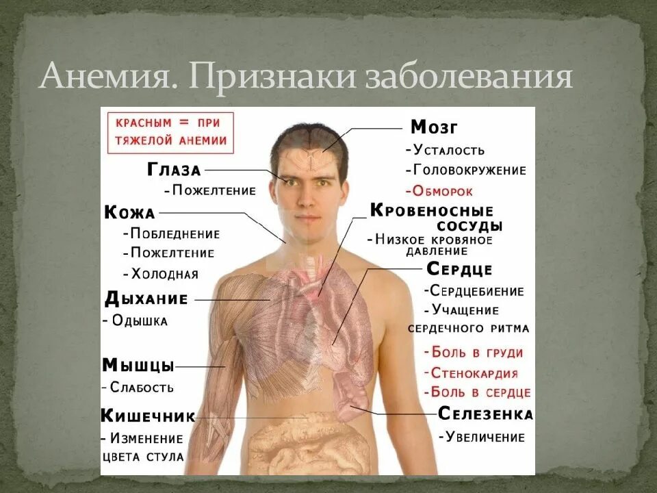 Заболевания сопровождающиеся анемией. Заболевания при анемии.