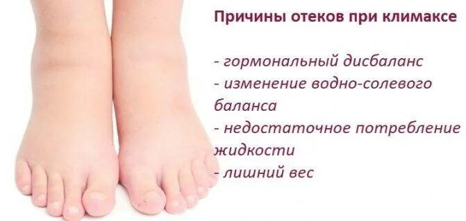 Ноги отекают причины у женщины 50. Сильно отекают ноги причина.