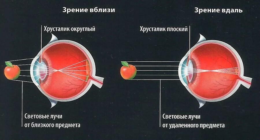 Точка лежащая зрение. Механизм аккомодации глаза схема. Аккомодация хрусталика. Аккомодация хрусталика глаза. Спазм аккомодации схема.