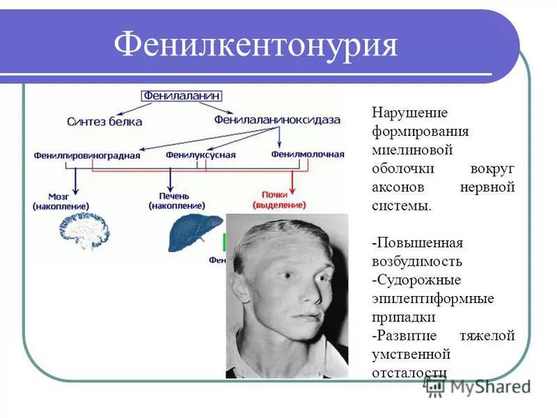 Нарушение развитие пола