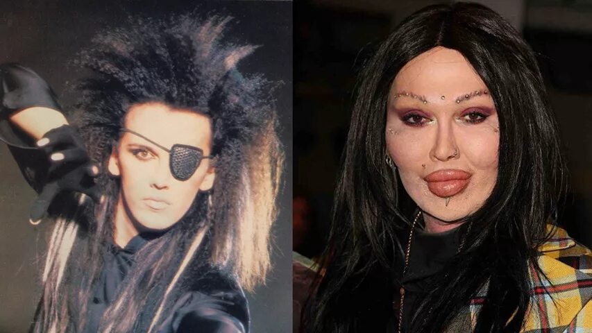 пит бернс 1983. пит пластика. пит пластика. пит пластика. пит пластика.