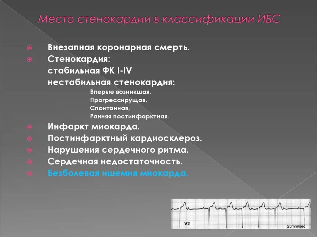 Клиника стабильной и нестабильной стенокардии. Нестабильная стенокардия классификация. Нестабильная стенокардия i клиника. ЭКГ при нестабильной стенокардии.