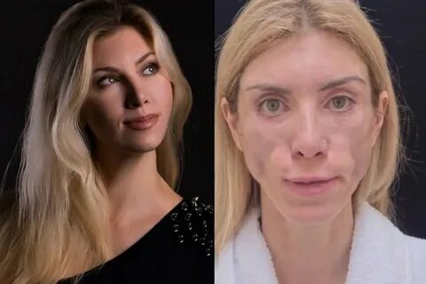 После операции стало хуже