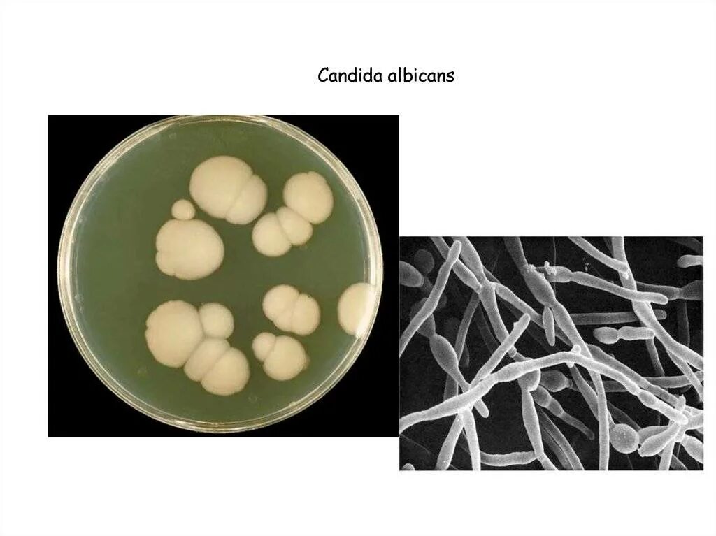 Дрожжеподобные грибы candida. Дрожжеподобные грибы кандида. Грибы альбиканс кандида микробиология. Дрожжеподобный грибок рода кандида -.