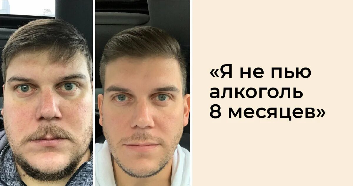 Изменился 3. Изменения после отказа от алкоголя. Месяц без алкоголя. Лицо месяц без алкоголя. Изменение человека после отказа от алкоголя.