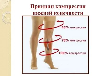Компрессия нижних конечностей