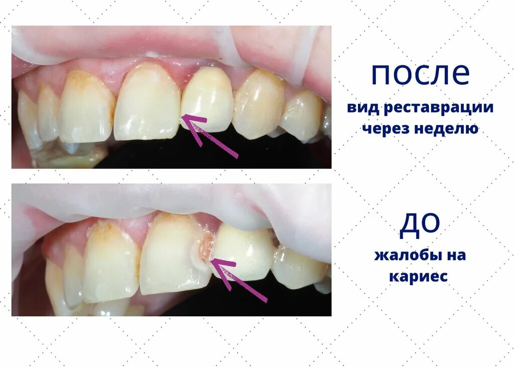 Стоматолог выборг. Stom_ID, Выборг стоматология-Выборг. Стоматология Выборг Ленина. Стоматология Выборг Экстра. 32 Норма стоматология Выборг.