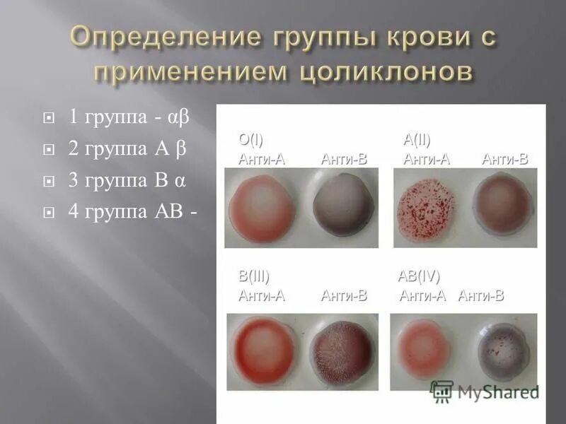 Группа крови по цоликлонам