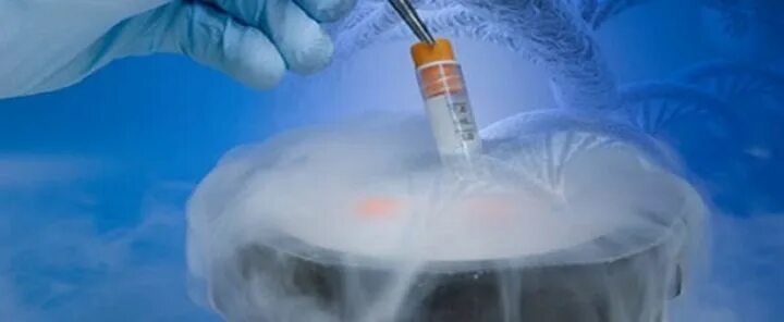 Лечение заморозкой. Криоконсервация яйцеклеток. Криоконсервация эмбрионов. Криоконсервация геномов. Криоконсервация клеток.