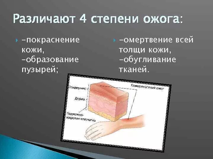 Установите соответствие степени ожога. Солнечные ожоги 1 и 2 степени. Ожог кожи первой степени.