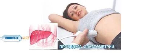 Ластометрия. Ластометрия. Ластометрия. Эластография (эластометрия) печени. Эластометрия самый высокий показатель.