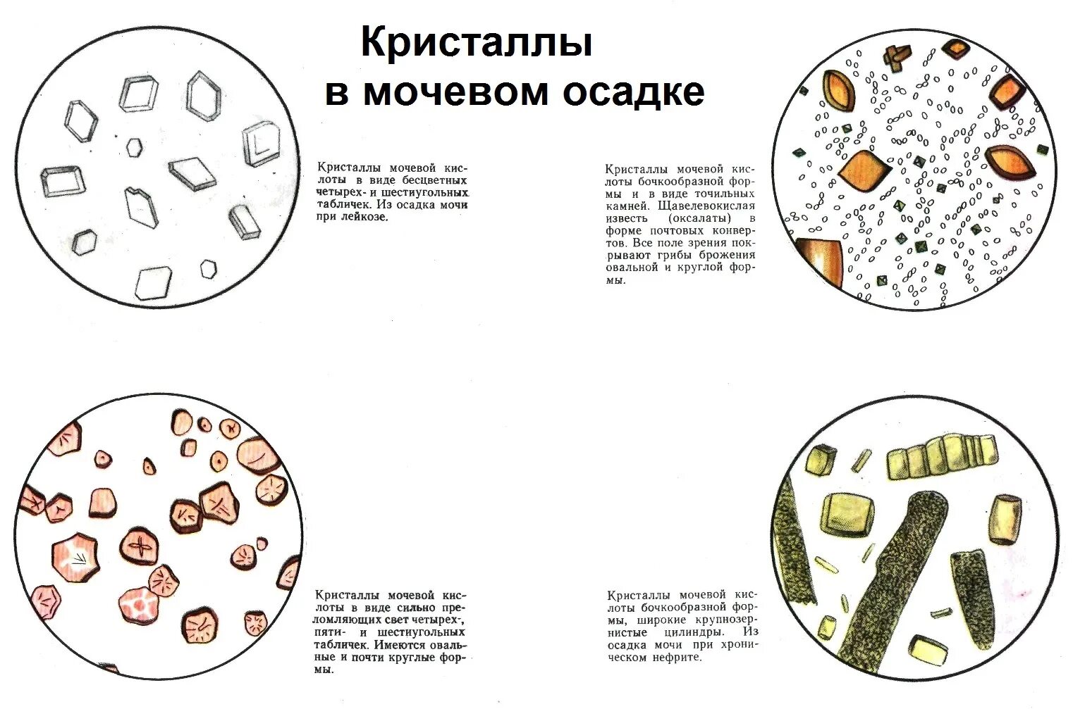 Микроскопические осадки мочи