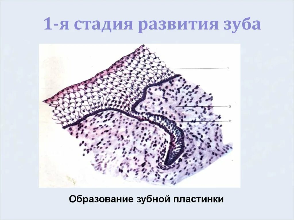 Стадии развития зуба. Поздняя стадия развития зуба гистология. Развитие зуба 3 стадия гистология. Первая стадия развития зуба.