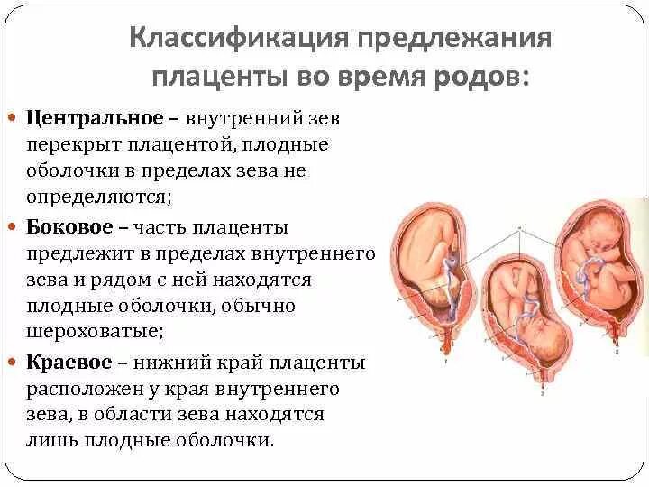 Предлежание плаценты область внутреннего зева. Ультразвуковая классификация предлежания плаценты. Предлежание плаценты боковое центральное. Типы прикрепления плаценты.