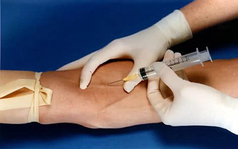 инъекции кровью