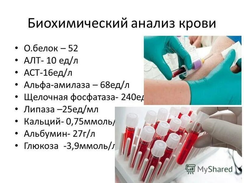 Подготовка к сдаче анализов биохимии. Анализ крови. Биохимический анализ крови. Клиническое исследование крови. Общий анализ крови анализ крови.