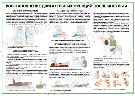 Истории восстановления после инсульта