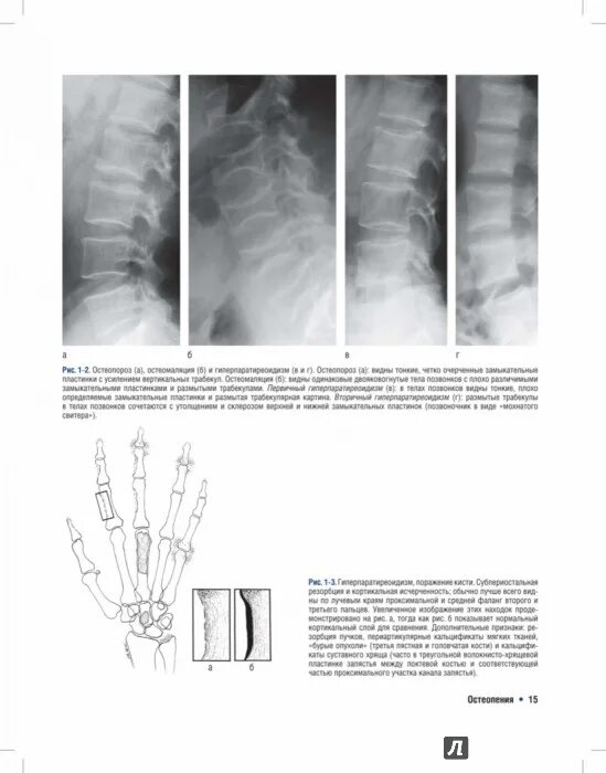 перилунарный вывих запястья. томография костей скелета. лучевая диагностика заболеваний костей руководство. лучевая диагностика костей и суставов. лучевая диагностика костей и суставов.