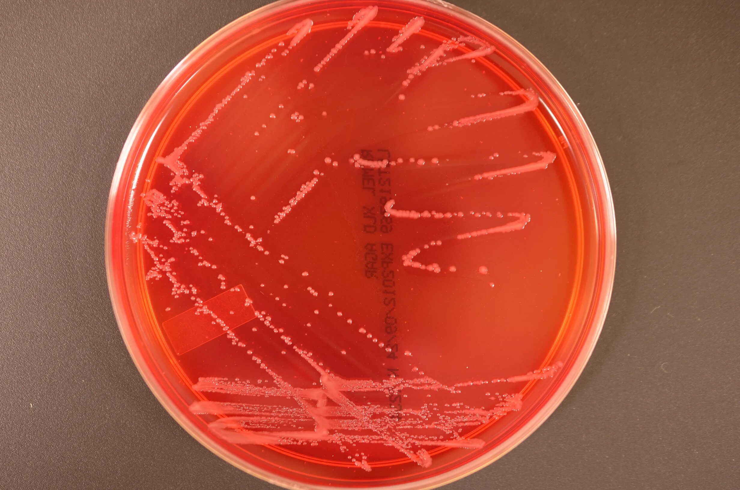 Ба агар. Агар XLD Shigella. Шигелла на XLD. XLD агар рост сальмонелл. Сальмонелла шигелла агар.