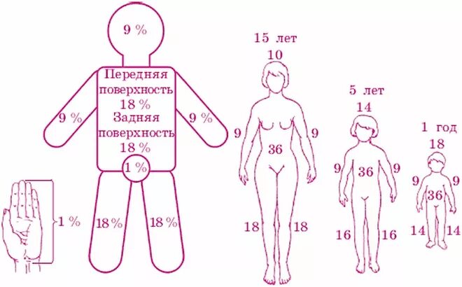 Площадь поражения при ожогах. Площадь ожога в процентах у взрослых. Площадь ожогов правило девяток. Площадь поражения ожогов у детей. Оценка степени ожога у детей.